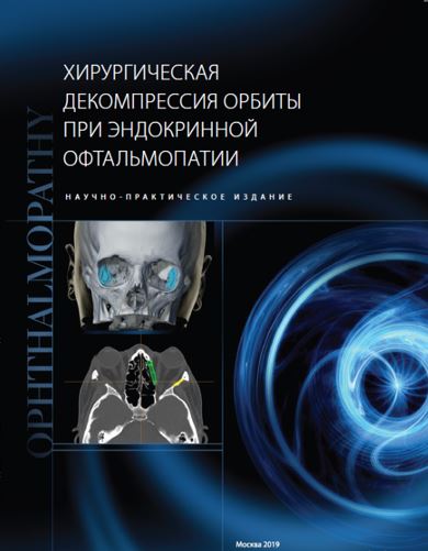 Хирургическая декомпрессия орбиты при эндокринной офтальмопатии